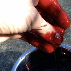 Hemoglobin