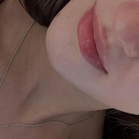 Felca