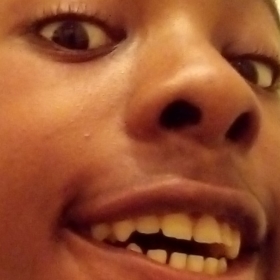 rigidity_teeth_man