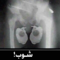 syriano
