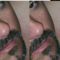 blavad